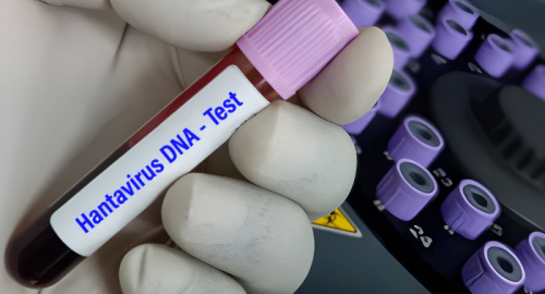 Incubo Hantavirus: l�emergenza sanitaria della MV Hondius